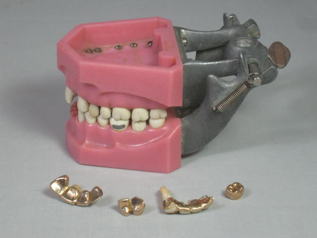 Vtg Columbia Dentoform Dental Mold Form w/Gold Teeth Fillings Bridges Crowns NR!