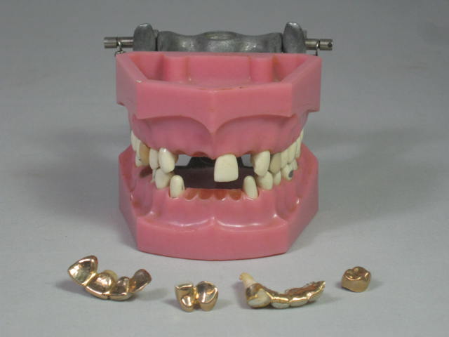 Vtg Columbia Dentoform Dental Mold Form w/Gold Teeth Fillings Bridges Crowns NR! 1