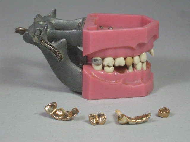 Vtg Columbia Dentoform Dental Mold Form w/Gold Teeth Fillings Bridges Crowns NR! 2