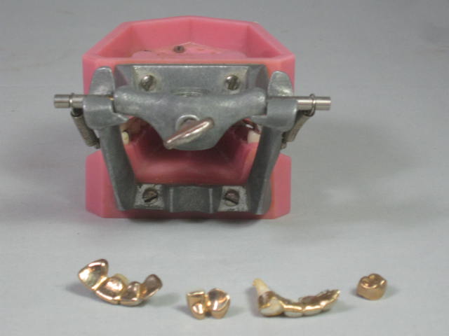Vtg Columbia Dentoform Dental Mold Form w/Gold Teeth Fillings Bridges Crowns NR! 3