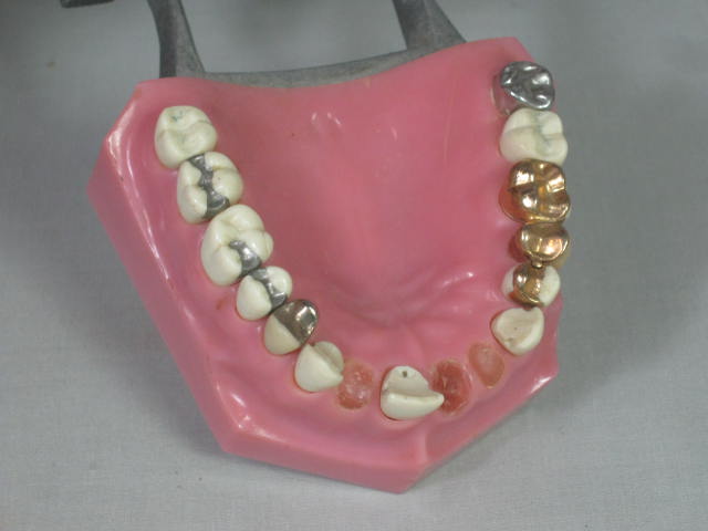 Vtg Columbia Dentoform Dental Mold Form w/Gold Teeth Fillings Bridges Crowns NR! 6