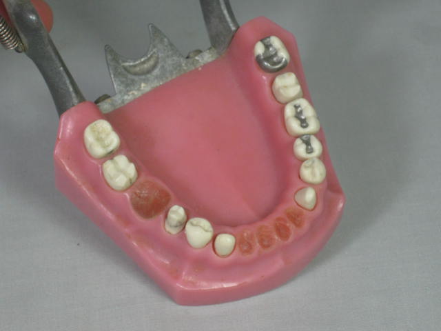 Vtg Columbia Dentoform Dental Mold Form w/Gold Teeth Fillings Bridges Crowns NR! 7