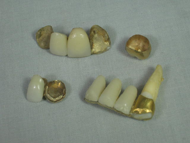 Vtg Columbia Dentoform Dental Mold Form w/Gold Teeth Fillings Bridges Crowns NR! 9